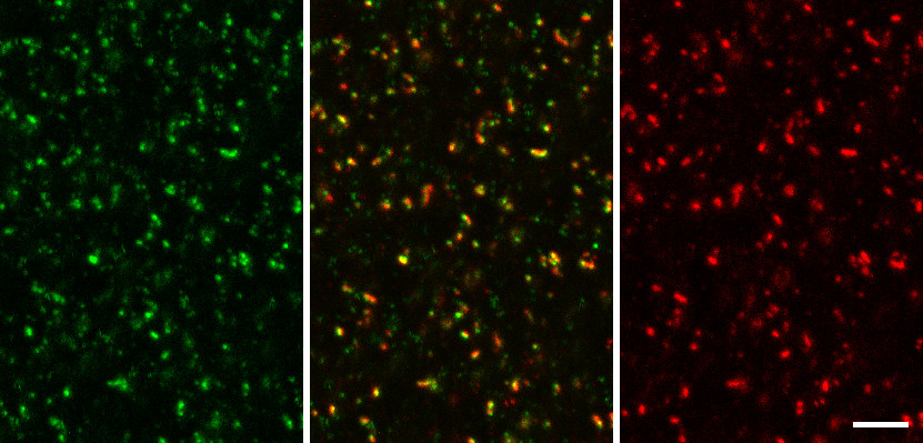 RIM1/2, Polyclonal Guinea pig purified antibody